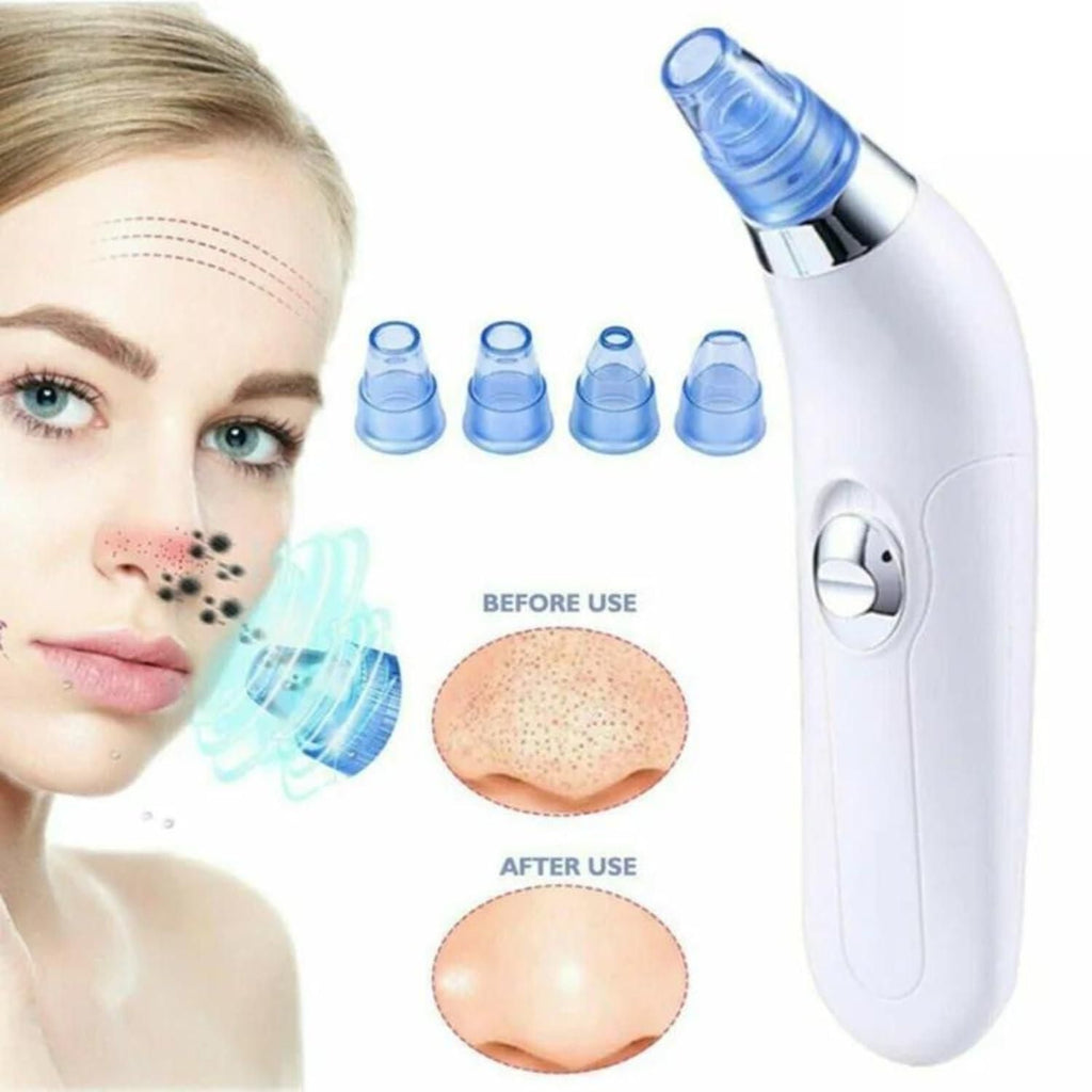Multi Functional Blackhead Remover